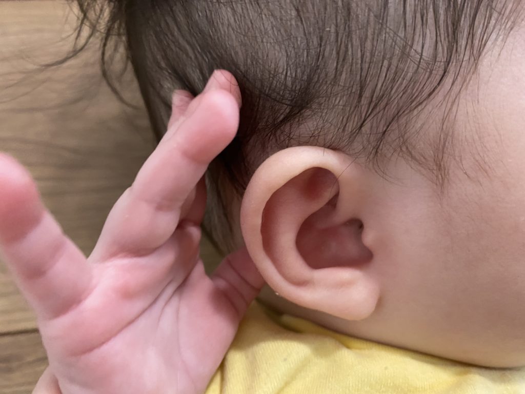 【6m】耳をかいたら耳鼻科のサイン！耳掃除を受診したら「滲出性中耳炎」だった